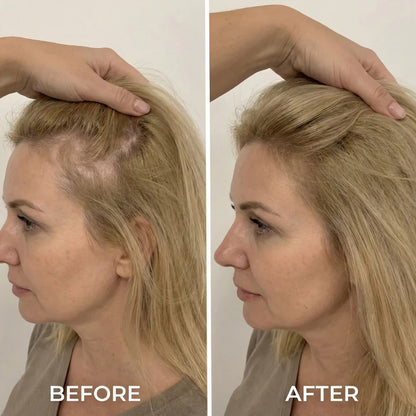 Serorgen™ Hair Growth Serum