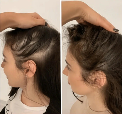 Serorgen™ Hair Growth Serum
